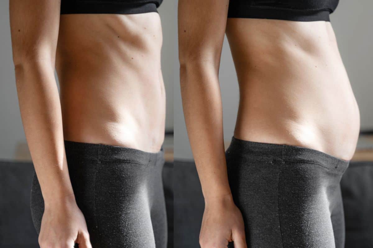 How long does diastasis recti take to improve Yeovil?