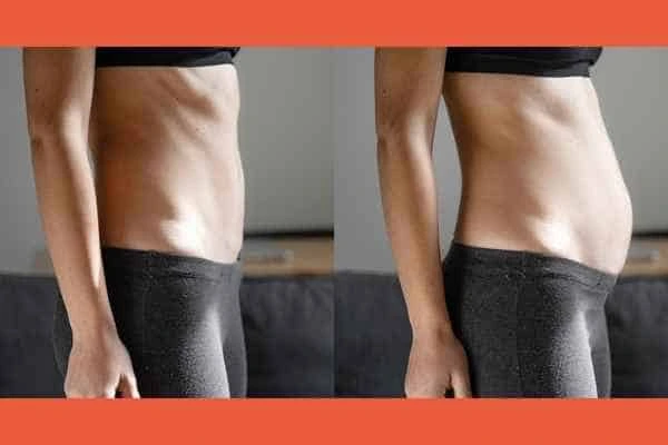 LA-EMS Body Sculpting results Yeovil