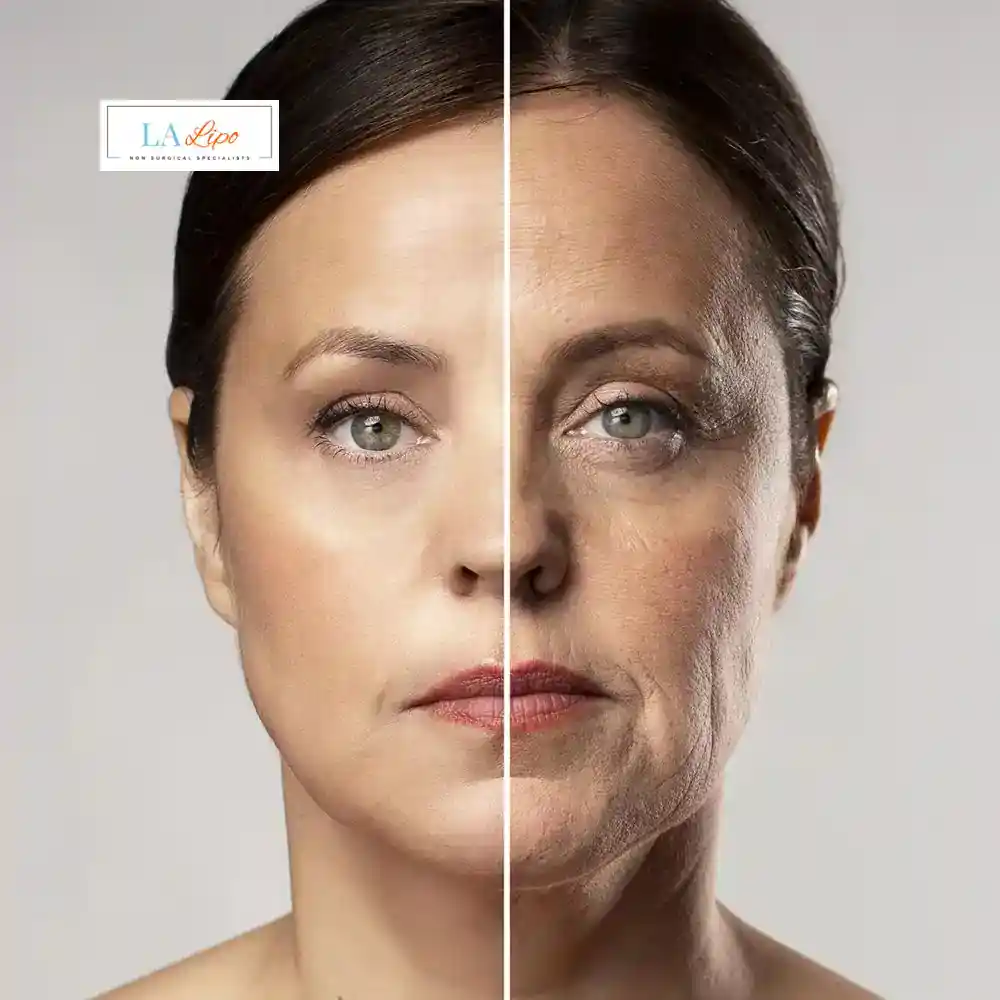 How Can You Tell If Non-Surgical Skin Tightening Is Right for You Yeovil?